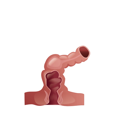 Rectum medical illustration